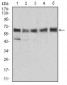 ALDH6A1 Antibody