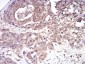 CFHR5 Antibody