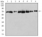 DDX5 Antibody