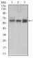 BMPR1A Antibody