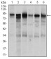 TGFBR3 Antibody