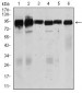 TGFBR3 Antibody