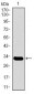 SLC27A5 Antibody