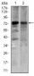 SLC27A5 Antibody