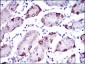 SLC27A5 Antibody