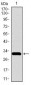 SLC27A5 Antibody