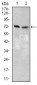 SLC27A5 Antibody