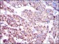 SLC27A5 Antibody