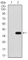 SLC27A5 Antibody