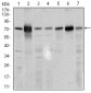 SLC27A5 Antibody