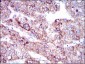 SLC27A5 Antibody