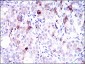 SLC27A5 Antibody