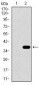 SLC27A5 Antibody