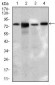 SLC27A5 Antibody