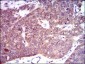 PDE1B Antibody