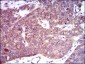 PDE1B Antibody