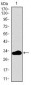 FCER1A Antibody