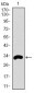 FCER1A Antibody