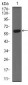 CK5 Antibody