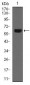 CK5 Antibody