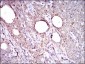 ALDH2 Antibody