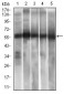 ALDH2 Antibody