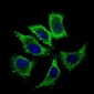 ALDH2 Antibody