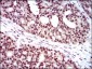 WHSC2 Antibody