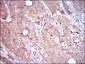 ITGB4 Antibody