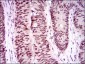 TP53BP1 Antibody