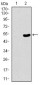 TP53BP1 Antibody