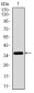 ITGA2B Antibody