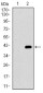 ITGA2B Antibody