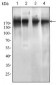 EGFR mutant Antibody