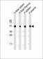 IGHG1 Antibody (Center)