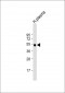 IGHG1 Antibody (Center)