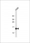 Galectin-1 Antibody