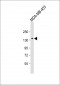 GRIN2A Antibody (C-term)