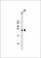 RRAS Antibody (Center)