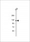 COL1A2 Antibody (N-term)