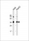 AKR1C3 Antibody (Center)