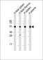 IGHG1 Antibody (Center)