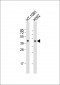 PCYT1A Antibody (N-term)