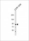 MDM2 Antibody (S166)