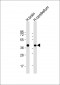 SYP Antibody (C-term)