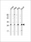 ANP32A Antibody (Center)