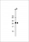 HLA-DPB1 Antibody (Center)