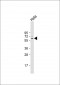 BECN1 Antibody (N-term T72)