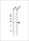 CD8A Antibody (N-term)