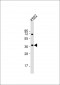 BLVRA Antibody (C-term)